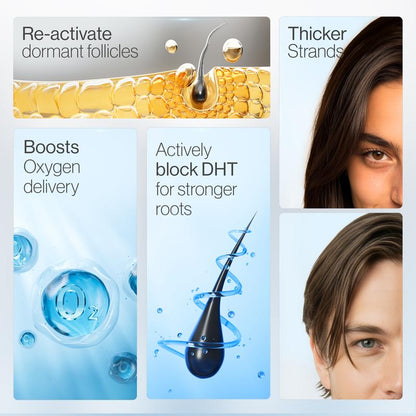 Niveano™ Hair Density Roll-On Serum – Your Monthly Scalp Care Boost for Fuller-Looking Hair